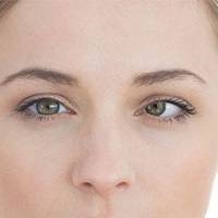 GÖZ NEZLESİ SALGININA DİKKAT!