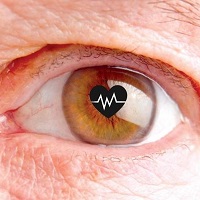 GÖZ NEZLESİ SALGININA DİKKAT!